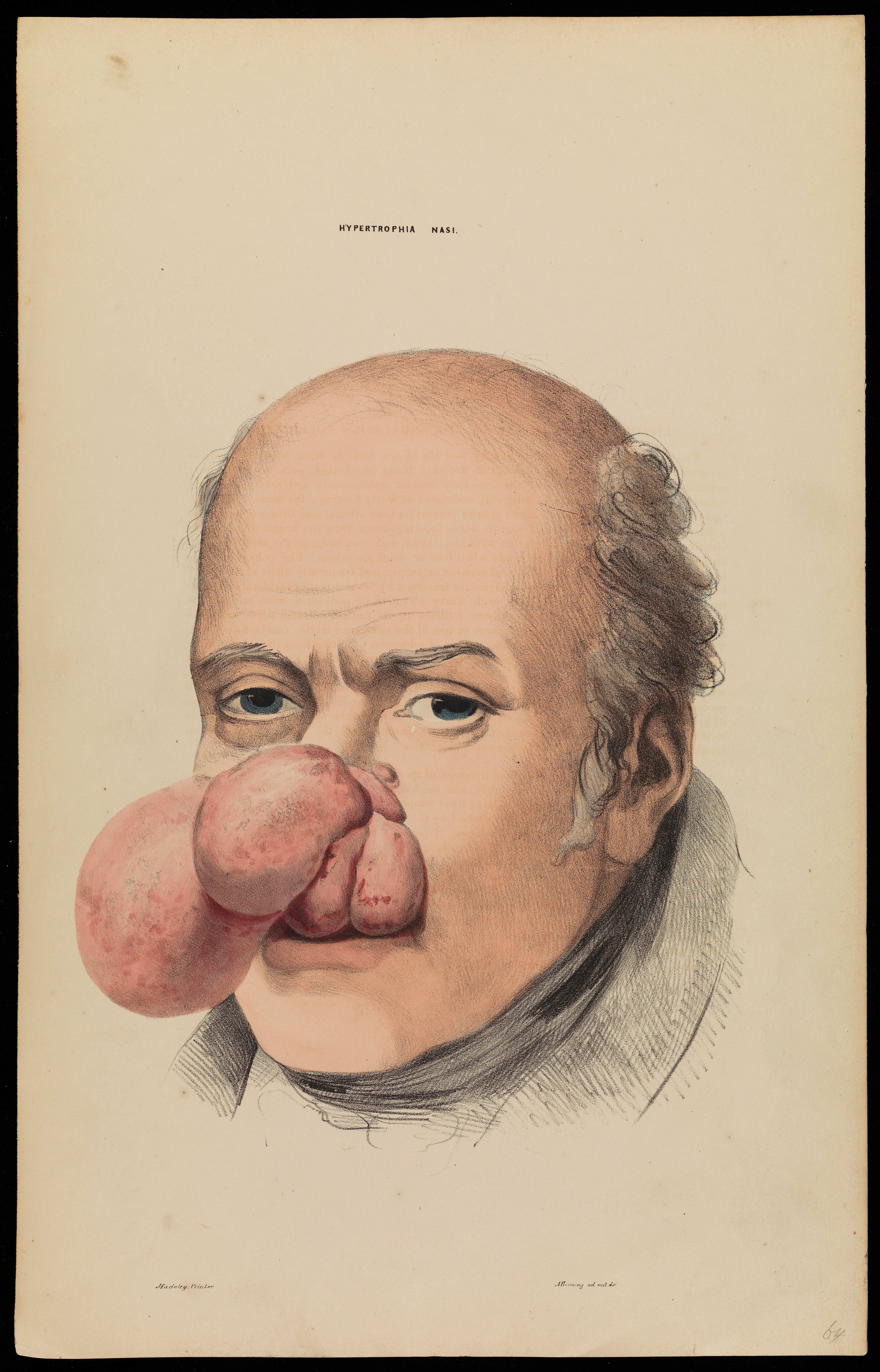 Ein Mann mit großer Nase, kurzen dunklen Haaren und herausgestreckter rosa Zunge, der konzentriert und fokussiert aussieht.